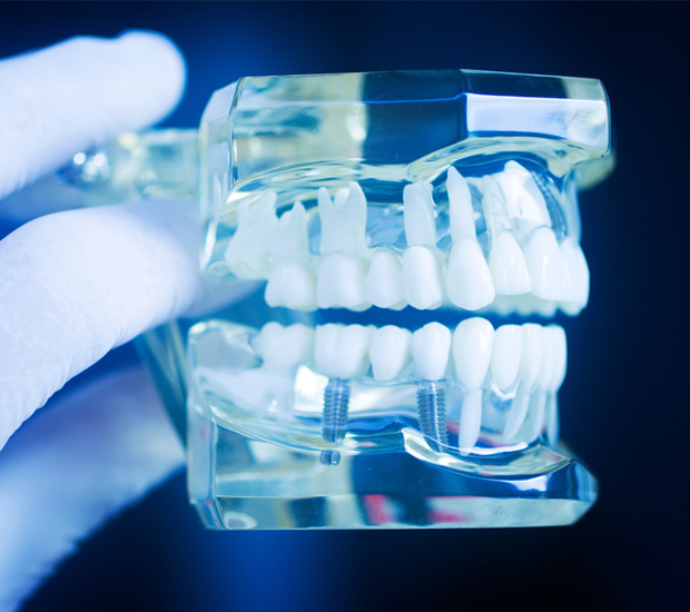 Freehold Dental Implant Restoration